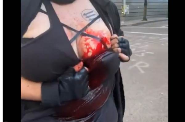  Portland Antifa Cries Out For Police Assistance After Woman They Appeared to Be Harassing Stabs One of Them