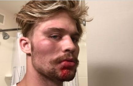  Antifa Terrorists Attack Independent Journalist in Portland — Beat Him Bloody