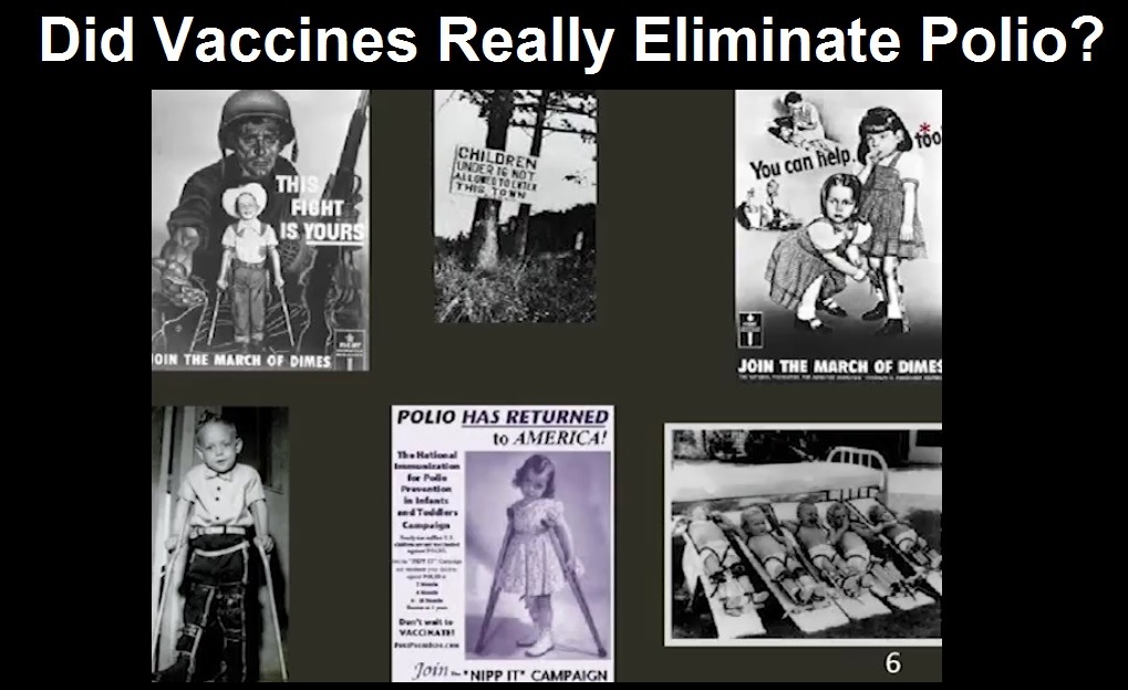  Did Vaccines Really Eliminate Polio? COVID-19 Shots Linked to Guillain-Barré Syndrome – Common Side Effect of Vaccines that Resembles Polio